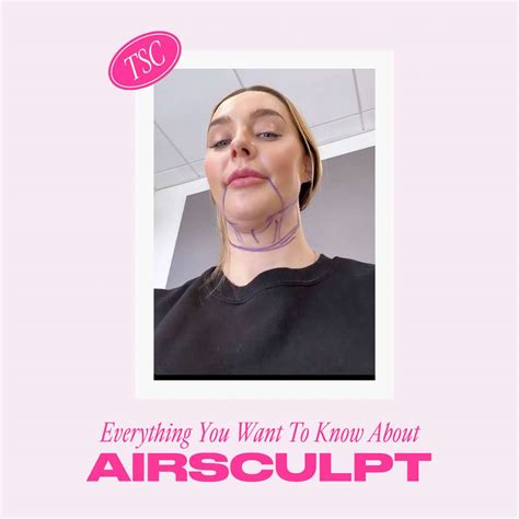 airsculpt reviews